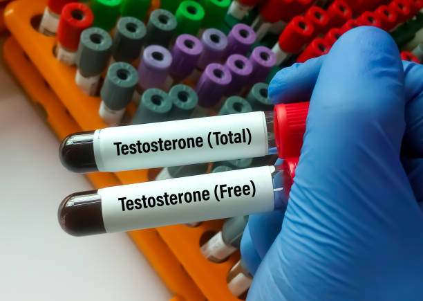 Free Testosterone